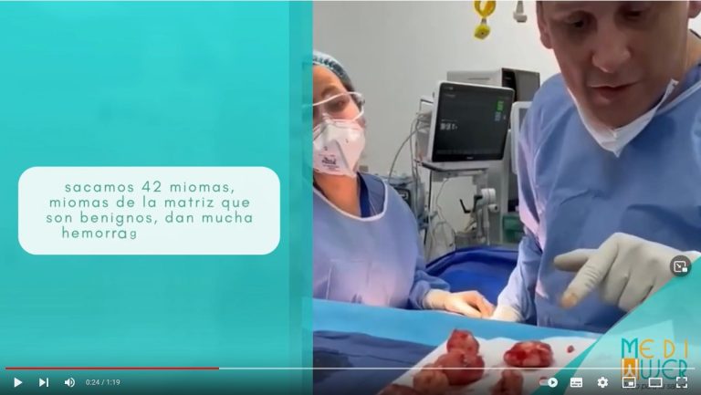 Miomectomía VideoYoutube
